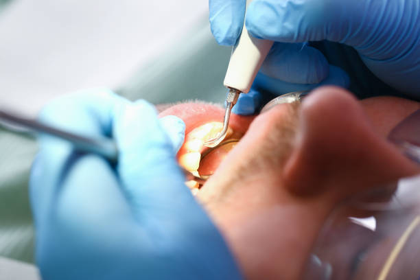 Best Emergency Treatment for Oral Infections in Bethany, MO