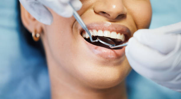 Best Broken or Chipped Tooth Repair in Bethany, MO